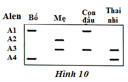 . C&oacute; khoảng 3% d&acirc;n số b&igrave;nh thường mang allele đột biến ở gene CFTR g&acirc;y bệnh xơ nang. Một nh&agrave; tư vấn di truyền nghi&ecirc;n cứu một gia đ&igrave;nh trong đ&oacute; cả bố v&agrave; mẹ đều l&agrave; thể mang về một đột biến CFTR.  (ảnh 1)