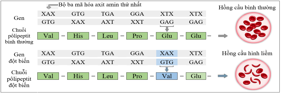 Câu 22.	Có bao nhiêu phát biểu sau đây đúng về bệnh hồng cầu hình liềm? (ảnh 1)