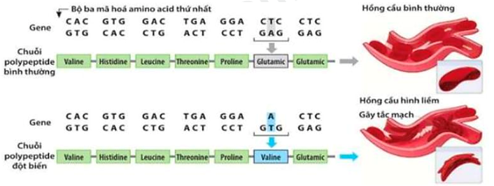 Hình bên mô tả trình tự bộ ba mã hóa gene và trình tự amino acid của hồng cầu bình thường và hồng cầu hình liềm (bị đột biến). (ảnh 1)
