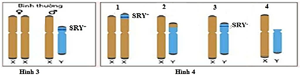 Ở người, trên cánh ngắn của NST Y có gene  SRY (sex-determining region Y gene ) quy định giới tính nam. Vì vậy, giới tính được quyết định bởi việc có hay không có NST Y mang vùng gene  SRY+;  (ảnh 1)