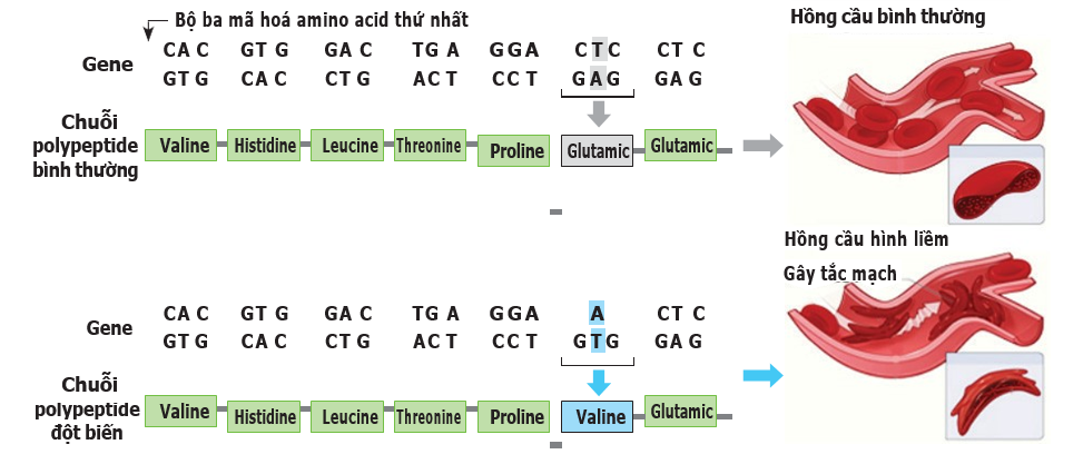 Hình dưới đây mô tả cơ chế phân tử của bệnh hồng cầu hình liềm. Quan sát  hình bên dưới và cho biết phát biểu nào sau đây đúng khi nói về đột biến hồng cầu hình liềm? (ảnh 1)