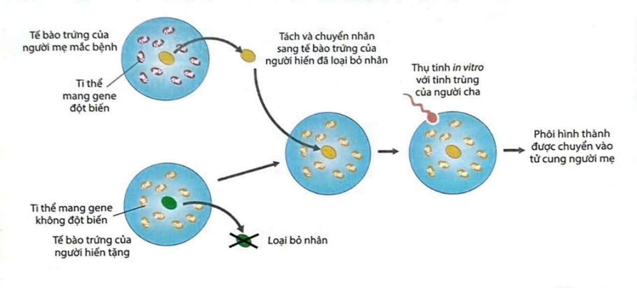 Để chữa bệnh di truyền do đột biến gene  ti thể gây ra ở người các chuyên gia đã sử dụng phương pháp sinh trẻ “ba cha mẹ” được mô tả bằng sơ đồ 2: (ảnh 1)
