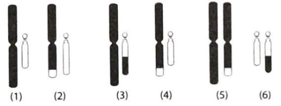 Một cặp vợ chồng đến tư vấn di truyền sau khi người vợ bị sảy thai liên tiếp và chưa sinh được người con nào. Khi phân tích bộ NST của cặp vợ chồng, người chồng bị chuyển đoạn giữa NST số 3 và NST số 21, (ảnh 1)