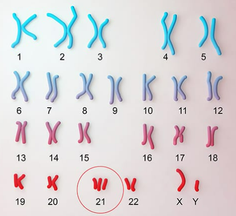 Quan sát hình ảnh sau đây và cho biết nhà tư vấn di truyền dựa vào cơ sở khoa học nào để tư vấn di truyền? (ảnh 1)