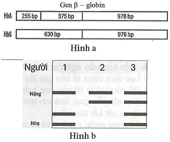 Gene 𝛽-globin quy định hình dạng hồng cầu có hai allele: Allele bình thường HbA và allele đột biến HbS. Khi phân tách hai allen này bằng enzyme đặc hiệu người ta thu được các đoạn DNA tương ứng được mô tả ở hình a (ảnh 1)