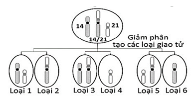 Một trong các nguyên nhân gây hội chứng Down ở người là do đột biến chuyển đoạn NST 14 và NST 21 (trong đó 1 NST 21 gắn với NST số 14 do đột biến chuyển đoạn Robertson hình thành 1 NST dài 14-21), (ảnh 1)