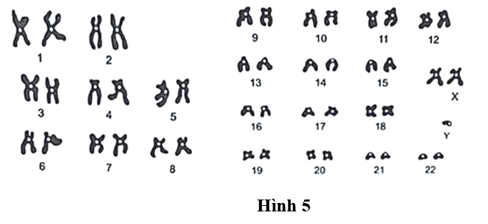 Hình 4 mô tả bộ nhiễm sắc thể trong tế bào sinh dưỡng ở một người mắc một hội chứng lệch bội. (ảnh 1)