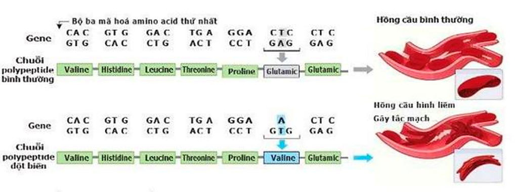 Đột biến gene gây ra bệnh thiếu máu hồng cầu hình liềm ở người được minh họa như hình dưới đây:   Phát biểu nào sau đây về loại đột biến này là đúng? (ảnh 1)