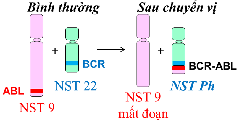 Nhiễm sắc thể Philadelphia là kết quả của một đột biến chuyển vị giữa nhiễm sắc thể 9 và 22, dẫn đến sự tạo thành gene  BCR-ABL. Bệnh nhân mang đột biến nhiễm sắc thể nói trên mang gene  BCR-ABL tạo ra một protein có hoạt tính kinase cao, (ảnh 1)