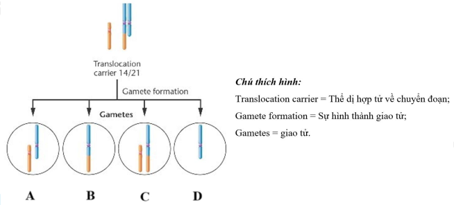 Chuyển đoạn Robertson là một dạng tái cấu trúc nhiễm sắc thể hiếm gặp bao gồm những dung hợp của 5 cặp nhiễm sắc thể tâm mút 13, 14, 15, 21 và 22 ở người. Các kiểu chuyển đoạn khác cũng xảy ra nhưng đều bị chết. (ảnh 1)