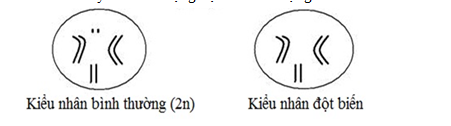 Từ sơ đồ kiểu nhân ở hình sau, hãy cho biết dạng đột biến số lượng nhiễm sắc thể nào đã xảy ra?   	A. Thể ba.	B. Thể bốn.	C. Thể không.	D. Thể một. (ảnh 1)