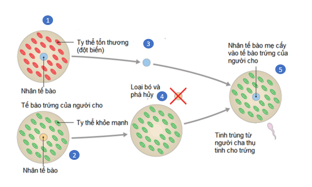 Vào năm 2017 phương pháp sinh trẻ “ba cha mẹ” được ứng dụng để chữa bệnh di truyền do đột biến gene ti thể. Sơ đồ dưới đây mô tả phương pháp sinh trẻ “ba cha mẹ” chữa bệnh di truyền do đột biến gene ti thể. (ảnh 1)
