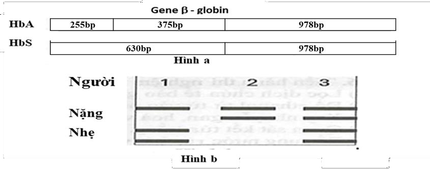 Gene 𝛽 - globin quy định hình dạng hồng cầu có hai allele: Allele bình thường HbA và allele đột biến HbS. Khi phân tách hai allele này bằng enzyme đặc hiệu người ta thu được các đoạn DNA tương ứng được mô tả ở hình a (ảnh 1)