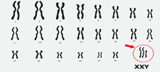 Tính trạng màu hoa do 2 cặp gene nằm trên 2 cặp NST khác nhau tương tác theo kiểu bổ sung, trong đó, có cả 2 gene A và B thì qui định màu đỏ, thiếu một trong hai gene A hoặc B thì quy định màu vàng, (ảnh 1)