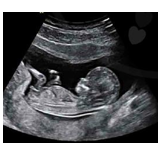 Hình bên là ảnh thai nhi trong bụng mẹ. Để tạo ra ảnh này bác sĩ đã sử dụng phương pháp (ảnh 1)