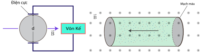 Trong y học, để chẩn đoán các bệnh lý về mạch máu như: phát hiện tắc nghẽn hoặc hẹp động mạch (ảnh 1)