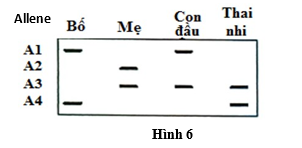 Có khoảng 3% dân số bình thường mang allene đột biến ở gene CFTR gây bệnh xơ nang.  (ảnh 1)