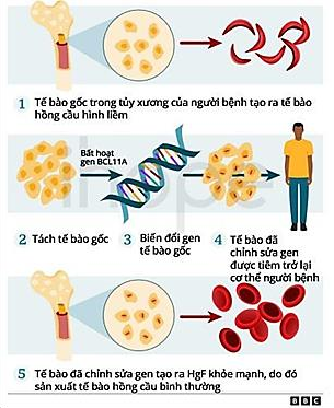 Liệu pháp Casgevy trong điều trị bệnh hồng cầu hình liềm là một phương pháp biến đổi gene tế bào gốc của chính bệnh nhân.  (ảnh 1)