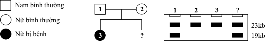 Bệnh phenylketon niệu là một bệnh di truyền đơn gen. Một loại enzyme cắt giới hạn có khả năng cắt các đoạn DNA tại vị trí của allele gây bệnh và allele bình thường (tạo ra các đoạn dài 23 kb hoặc 19 kb), được thể hiện trong Hình 3. (ảnh 2)