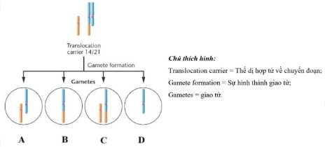 Chuyển đoạn Robertson là một dạng tái cấu trúc nhiễm sắc thể hiếm gặp bao gồm những dung hợp của 5 cặp nhiễm sắc thể tâm mút 13, 14, 15, 21 và 22 ở người.  (ảnh 1)