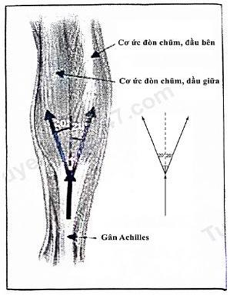 Cho hình vẽ về bó cơ của chân. Lực Ở gân Achilles bằng bao nhiêu nếu người chơi chỉ đứng bằng một chân? Coi tất cả các xương bàn chân là một khối cứng (hình B). Bỏ qua trọng lượng của xương b (ảnh 1)