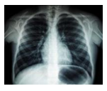 Nguyên nhân các vị trí trên phim chụp X-quang có độ đậm, nhạt khác nhau là do (ảnh 1)