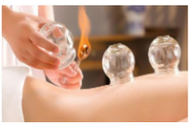 Một lọ giác hơi (được cơ sở điều trị bằng phương pháp cổ truyền sử dụng) do chênh lệch áp suất (ảnh 1)