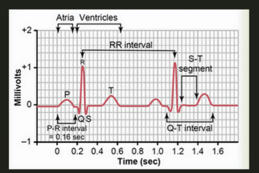 Điện tâm đồ (Electrocardiogram, ECG) là đồ thị ghi những thay đổi dòng điện tim. ECG gồm các sóng P, Q, R, S, T và các khoảng, đoạn tương ứng với hoạt động của tim. Hình 10 thể hiện ECG ở trạng thái bình thường của động vật có vú.  (ảnh 1)