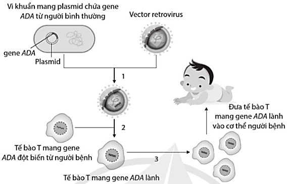 Hình vẽ mô tả sơ đồ quá trình điều trị rối loạn suy giảm miễn dịch (SCID) nhờ liệu pháp gene.  Các số 1, 2 và 3 trong hình 4.1 tương ứng là (ảnh 1)