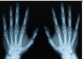 Hình bên là ảnh xương bàn tay được chụp bằng phương pháp  (ảnh 1)