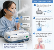 Trong các bệnh viện, máy xông khí dung chuyển thuốc từ dạng lỏng sang dạng sương mù để bệnh nhân hít vào phổi. Quá trình này liên quan đến các tính chất của chất khí và nhiệt học.  (ảnh 1)