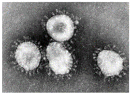 Để thu được hình ảnh của virus Corona (COVID – 19) như hình bên, người ta đã sử dụng dụng cụ quan sát nào sau đâu? (ảnh 1)
